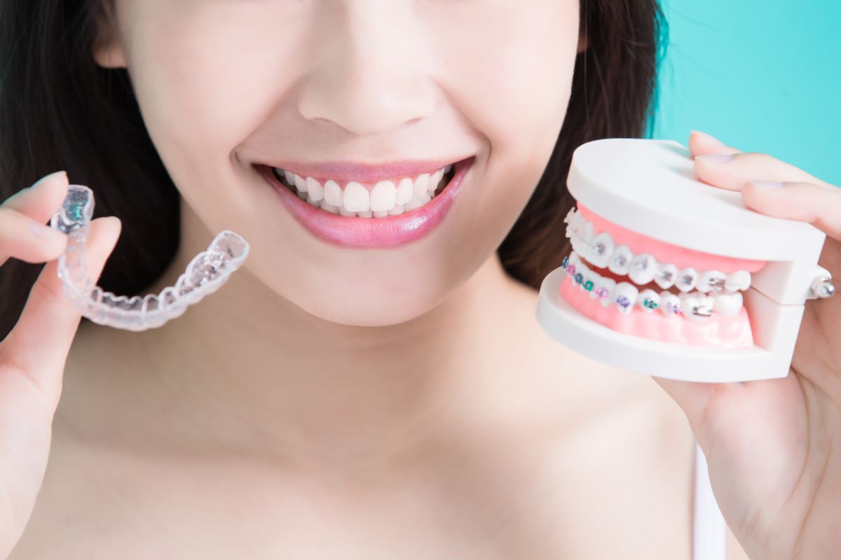 The Top 10 Braces Myths You Need to Know