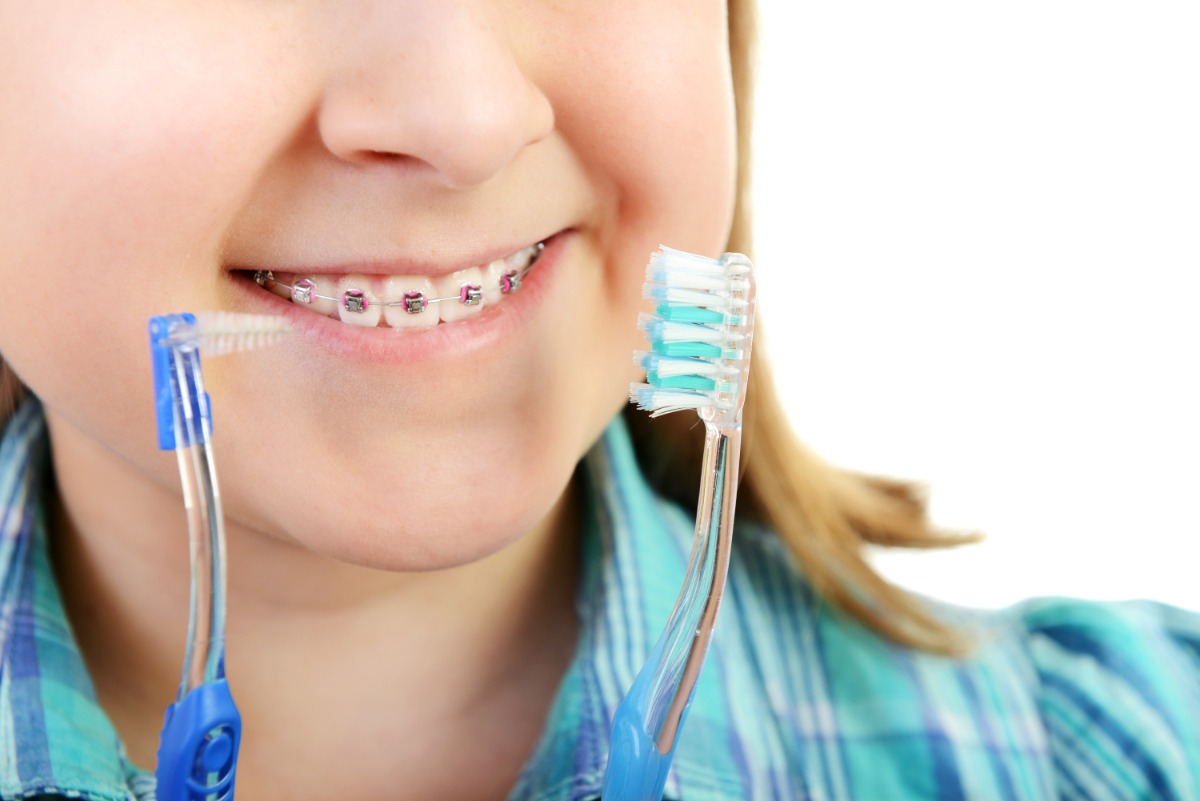 7 Tips for Brushing Your Teeth With Braces