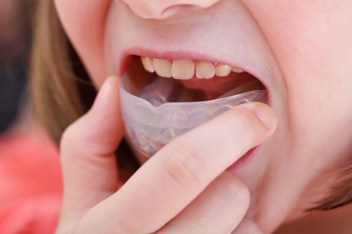 Sports-Related Mouth Protection and Orthodontic Emergencies