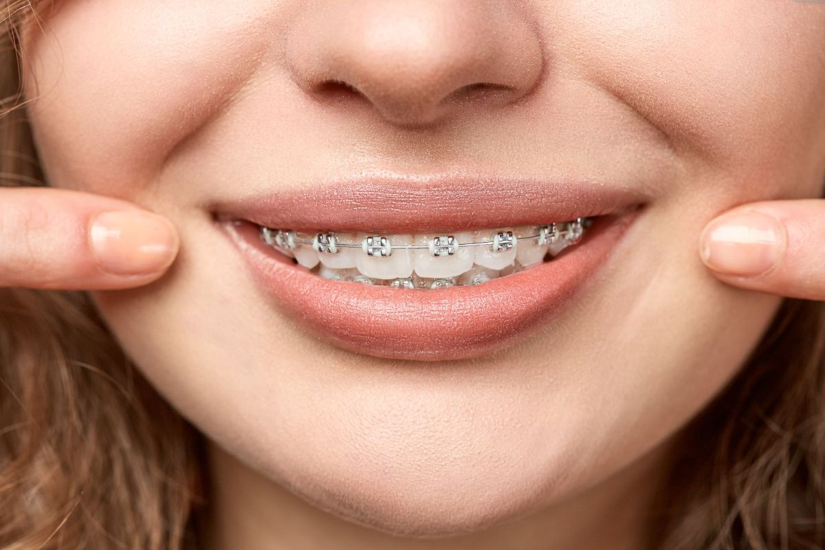 How Can Orthodontics Fix Facial Asymmetry?