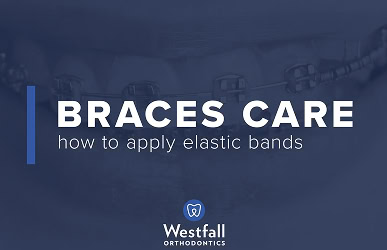 Elastic Bands